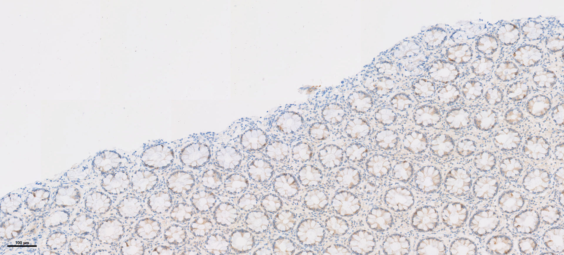 Human intestine 8_10x