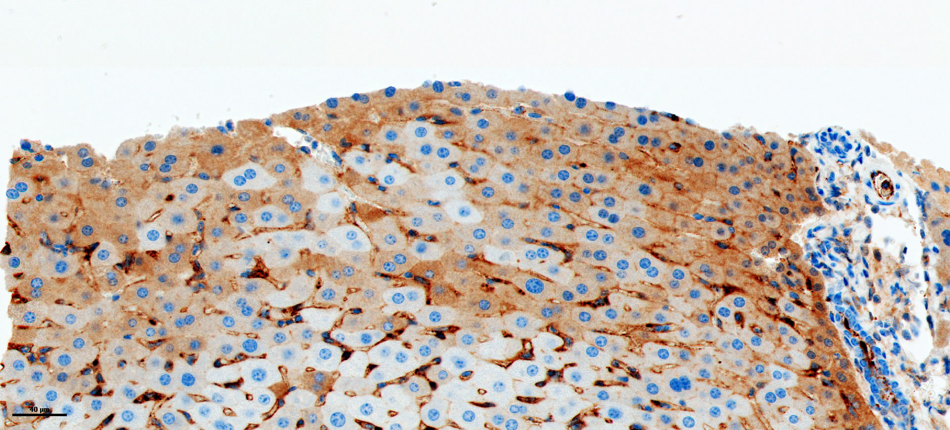 special_diet_TNF_liver_pRIPK3